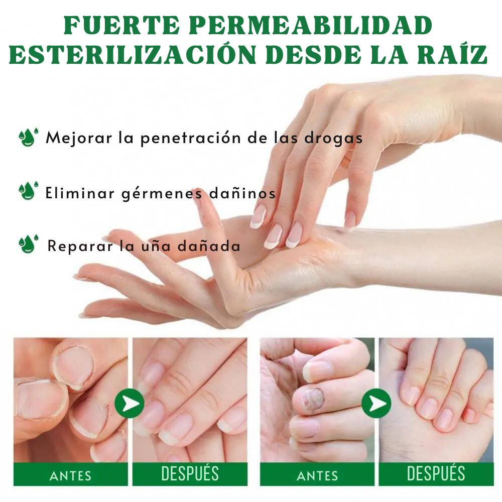 Suero antimicótico para uñas